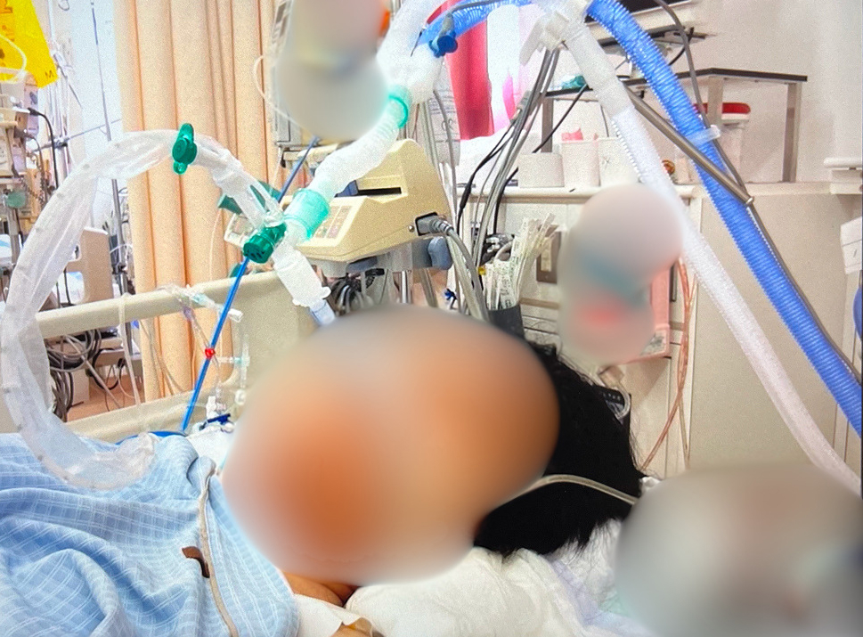 ICUで人工呼吸器や複数の医療チューブにつながれた患者の様子
